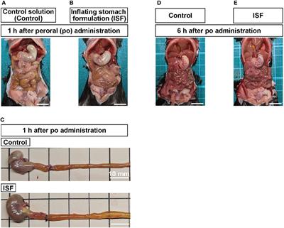 Gastrointestinal Distension by Pectin-Containing Carbonated Solution Suppresses Food Intake and Enhances Glucose Tolerance via GLP-1 Secretion and Vagal Afferent Activation